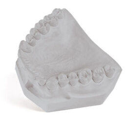 Gray display model of dental stone