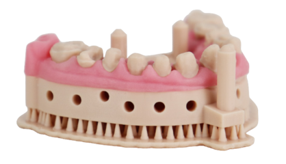 Example 3D printed dental model with beige base, and pink soft gingival material components