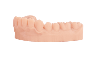 Example 3D printed Dental model in peach shade