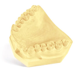 Buff display model of dental stone