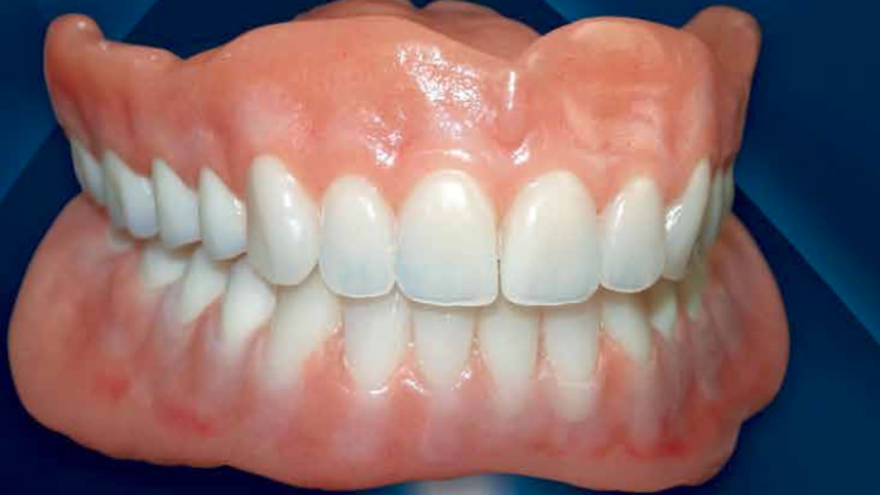 How 3D Resin Is Taking the Dental Lab Industry Into a New Era