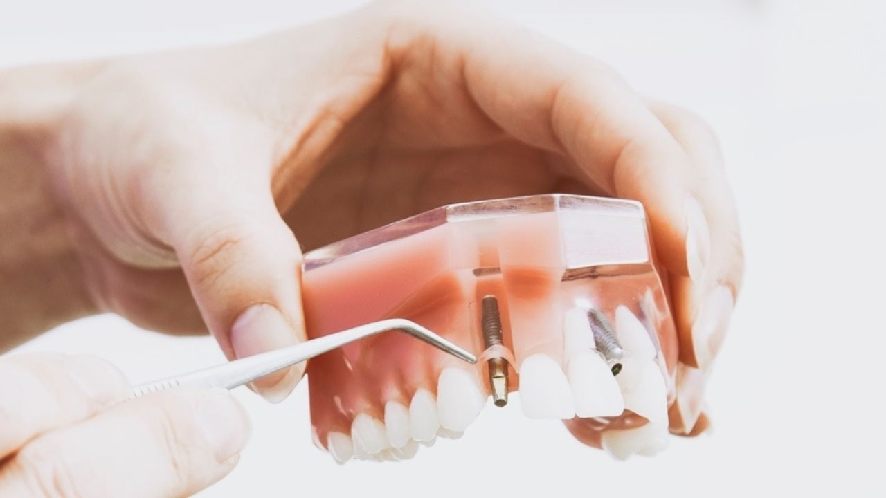 How the Right Dental Lab Supplier Can Make or Break Your Business