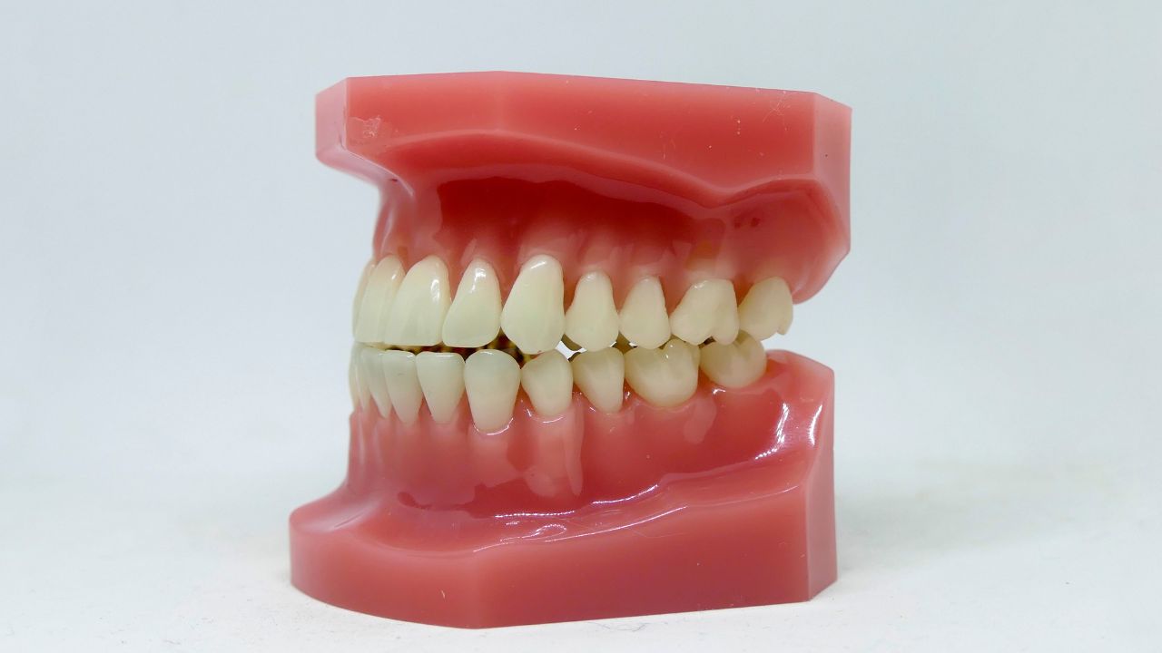 How to Choose the Right Acrylic Teeth for Your Denture