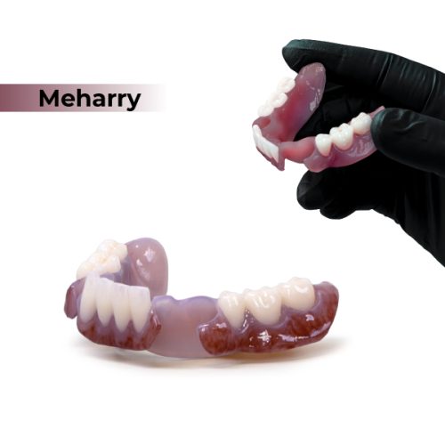 Rodin® BioArch RPD